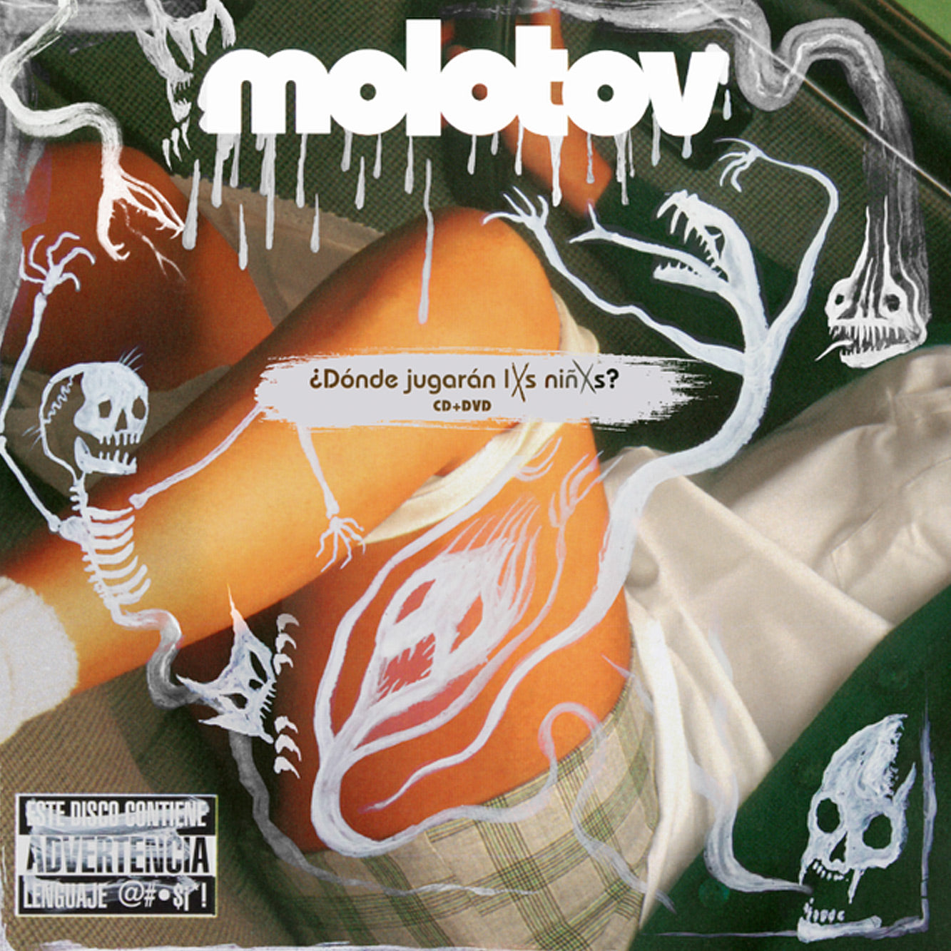 Molotov - Dónde Jugaran Las Niñas